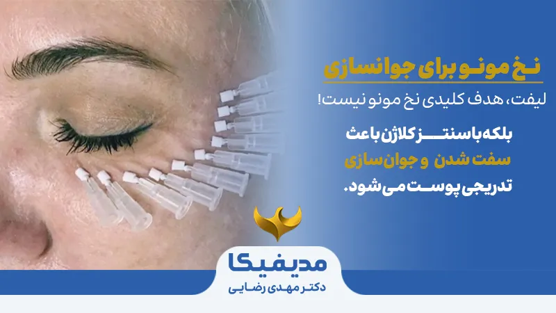 هزینه لیفت صورت با نخ