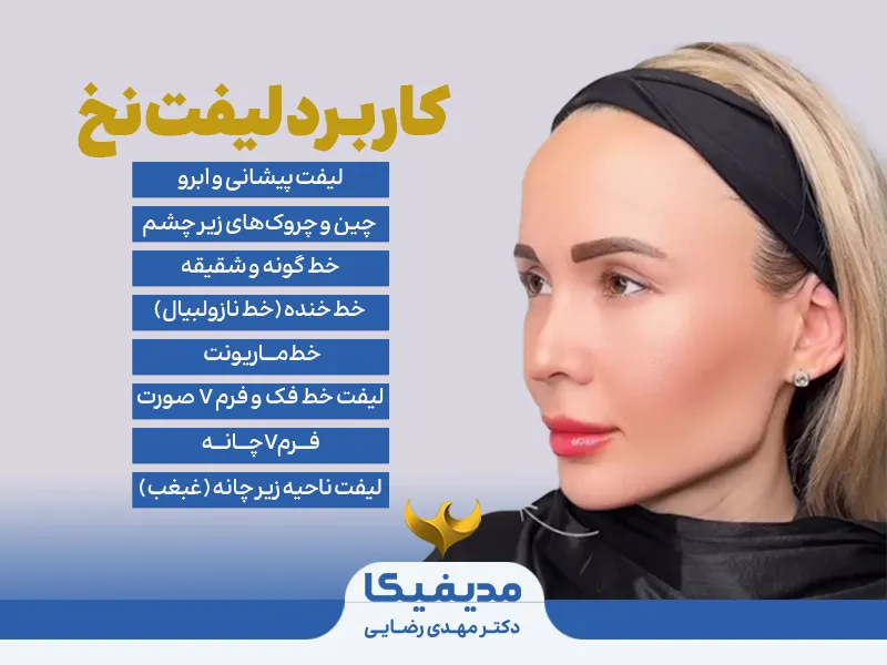 لیفت با نخ
