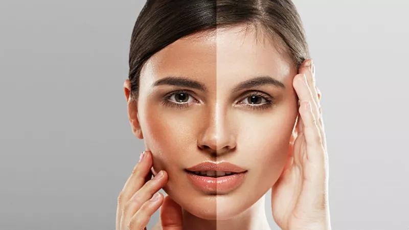 بهترین روش های روشن سازی پوست صورت