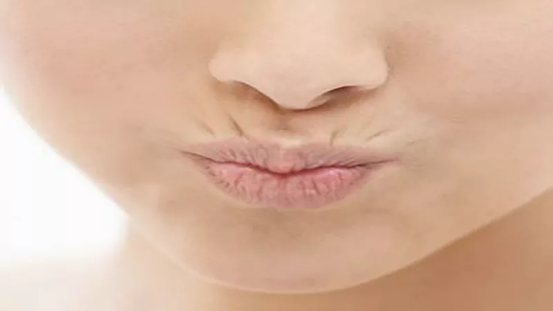 Wrinkles around the lips