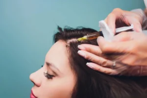 مقایسه مزوتراپی و کاشت مو